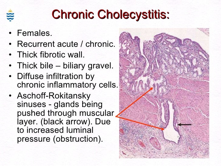 Disorders of Biliary System