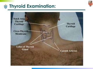 Thyroid Examination: 