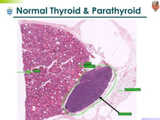 Normal Thyroid & Parathyroid 