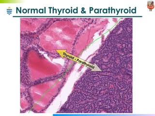Normal Thyroid & Parathyroid Thyroid - Parathyroid 
