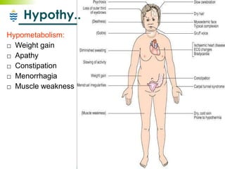 Hypothy.. Hypometabolism: Weight gain Apathy Constipation Menorrhagia Muscle weakness 