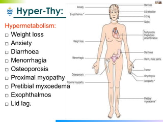 Hyper-Thy: Hypermetabolism: Weight loss Anxiety Diarrhoea Menorrhagia Osteoporosis Proximal myopathy Pretibial myxoedema Exophthalmos Lid lag. 