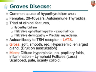 Graves Disease: Common cause of hyperthyroidism  (2%F) Females, 20-40years, Autoimmune Thyroiditis.  Triad of clinical features, Hyperthyroidism Infiltrative ophathalmopathy - exopthalmos Infiltrative dermopathy – Pretibial myxedema. Autoantibody to TSH receptor –  LATS . Gross : soft, smooth, red, Hyperaemic, enlarged gland. (Bruit on auscultation) Micro : Diffuse hyperplasia, ep. papillary folds,  inflammation – Lymphoid Follicles (Less)  Scalloped, pale, scanty colloid. 