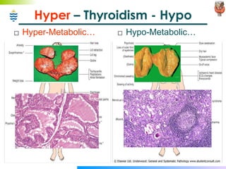 Hyper  – Thyroidism - Hypo  Hyper-Metabolic… Hypo-Metabolic… 