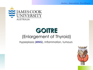 GOITRE (Enlargement of Thyroid) Hyperplasia ( MNG ), Inflammation, tumours   