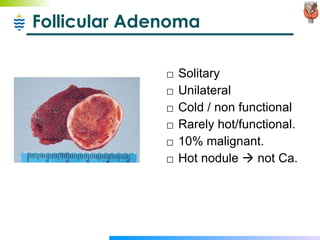 Follicular Adenoma Solitary Unilateral Cold / non functional Rarely hot/functional.  10% malignant. Hot nodule    not Ca. 