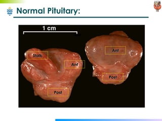 Normal Pituitary: Post Ant Stalk Post Ant 