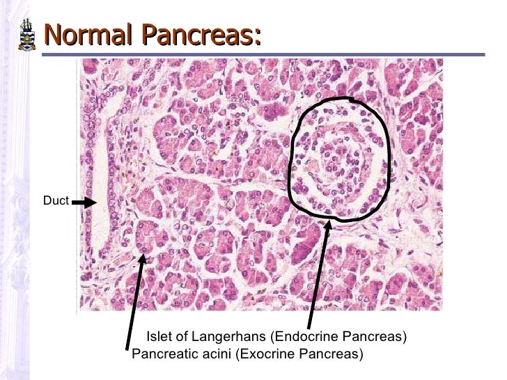 blood glucose test 4.3 Pathology Diabetes of blood glucose test 4.3 Pathology Diabetes of