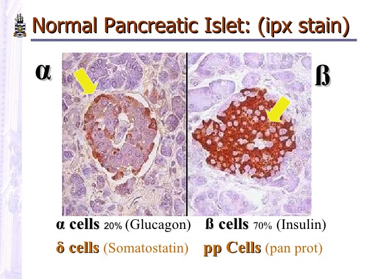 Hospitalized for high blood sugar image