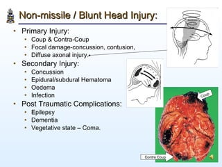 Non-missile / Blunt Head Injury:   <ul><li>Primary Injury: </li></ul><ul><ul><li>Coup & Contra-Coup </li></ul></ul><ul><ul...