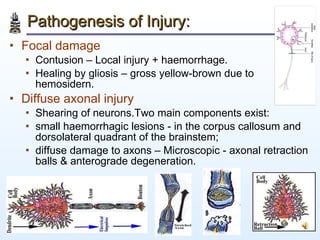 Pathogenesis of Injury: <ul><li>Focal damage </li></ul><ul><ul><li>Contusion – Local injury + haemorrhage.  </li></ul></ul...