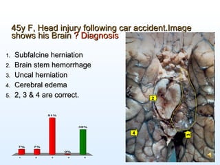 Pathology of Head Injury