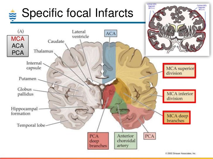 Pathology of Stroke & CVA