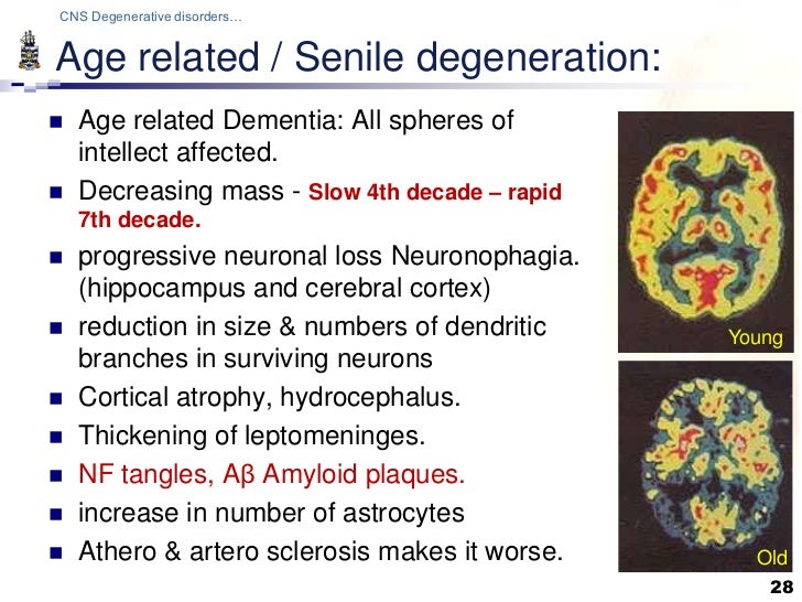 Pathology of CNS Degenerations Lecture
