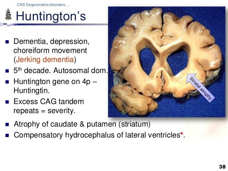 Pathology of CNS Degenerations Lecture