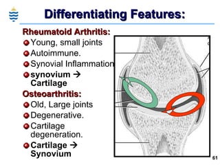 Differentiating Features: <ul><li>Rheumatoid Arthritis: </li></ul><ul><li>Young, small joints </li></ul><ul><li>Autoimmune...
