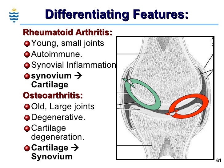 Pathology of Arthritis