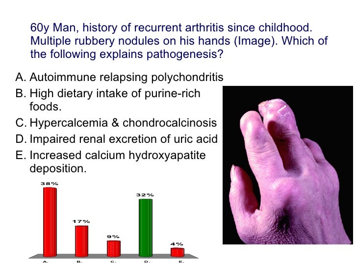 Pathology of Arthritis