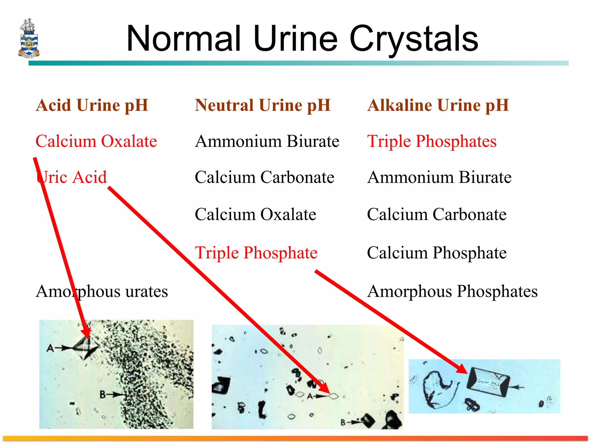 Normal Urine Crystals  Acid Urine pH   Neutral Urine pH   Alkaline Urine pH   Calcium Oxalate   Ammonium Biurate  Triple Phosphates   Uric Acid  Calcium Carbonate  Ammonium Biurate  Calcium Oxalate  Calcium Carbonate  Triple Phosphate   Calcium Phosphate  Amorphous urates  Amorphous Phosphates  