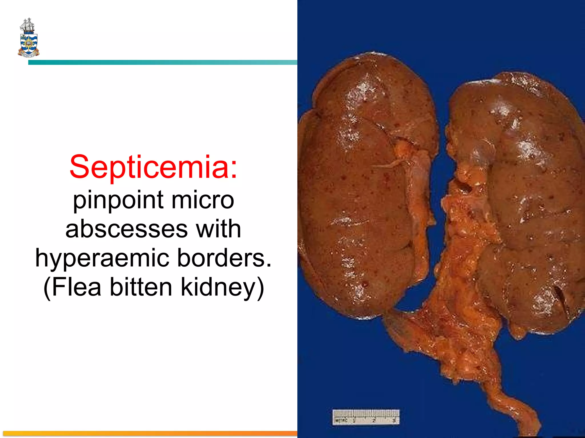 Septicemia:   pinpoint micro abscesses with hyperaemic borders. (Flea bitten kidney) 
