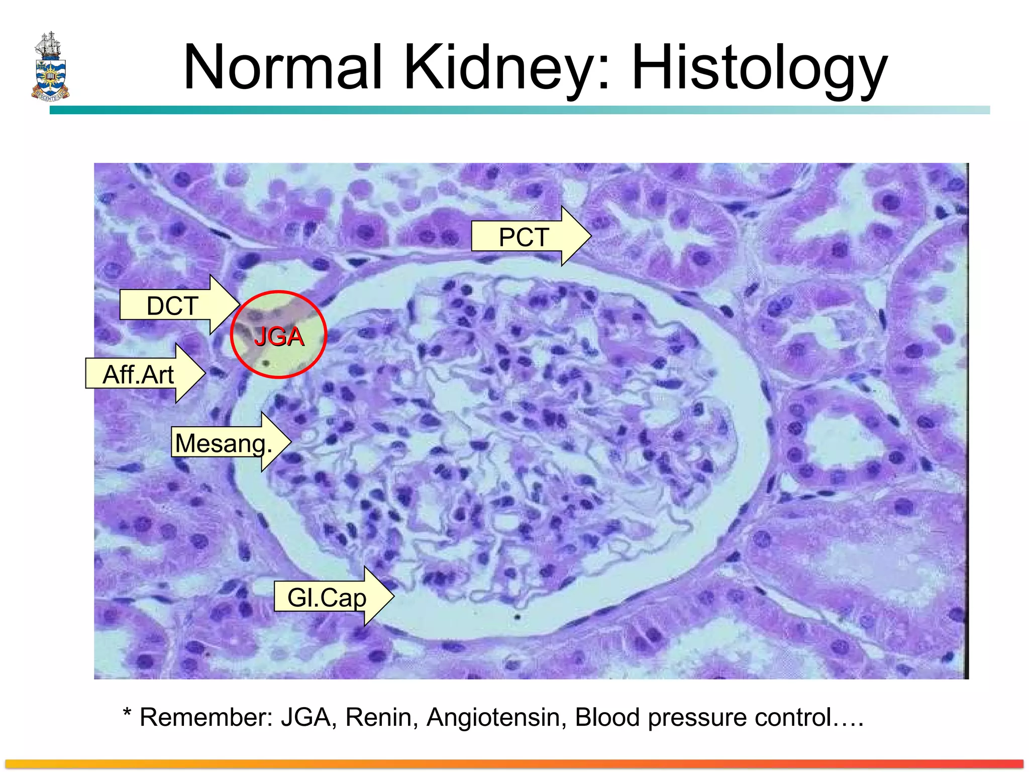 Normal Kidney: Histology DCT PCT Gl.Cap Mesang. Aff.Art JGA * Remember: JGA, Renin, Angiotensin, Blood pressure control…. 