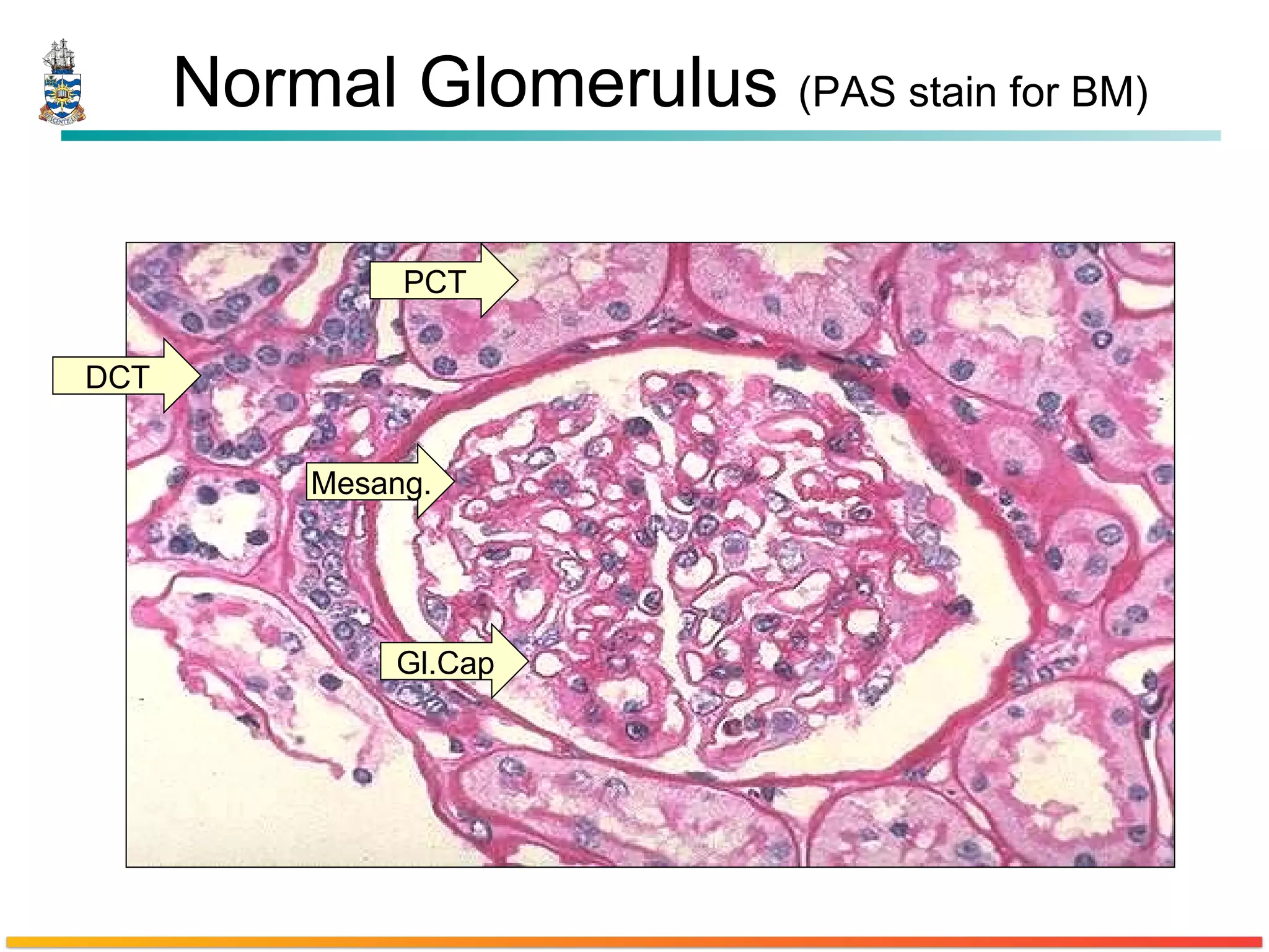 Normal Glomerulus  (PAS stain for BM) DCT PCT Gl.Cap Mesang. 