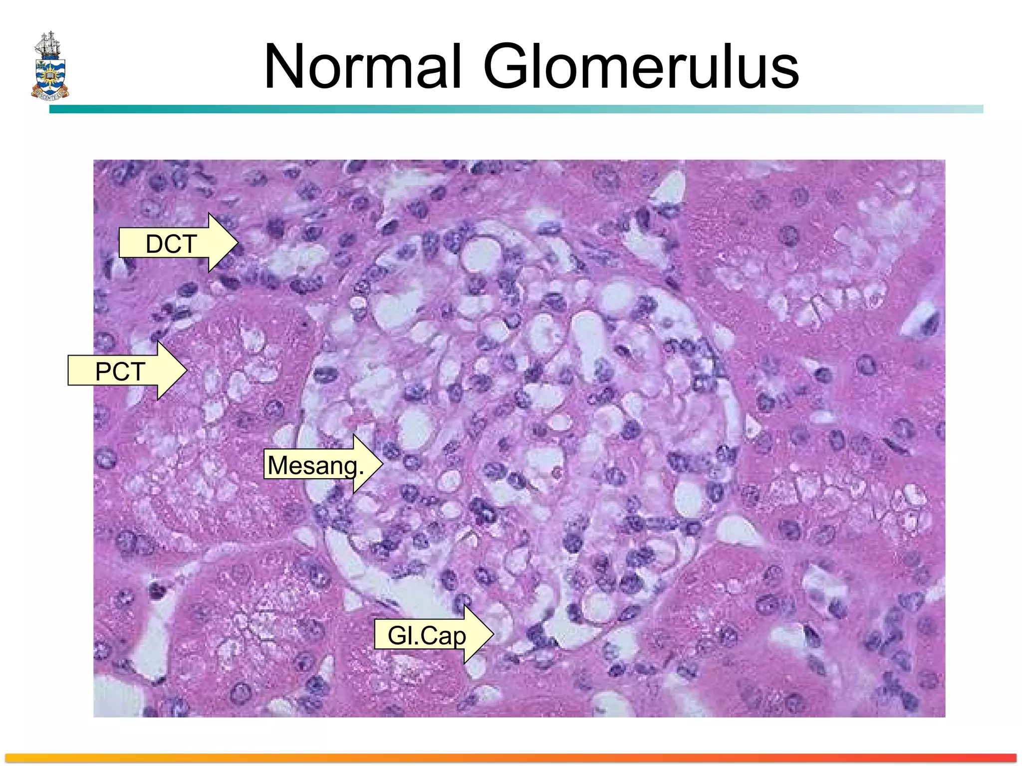 Normal Glomerulus DCT PCT Gl.Cap Mesang. 