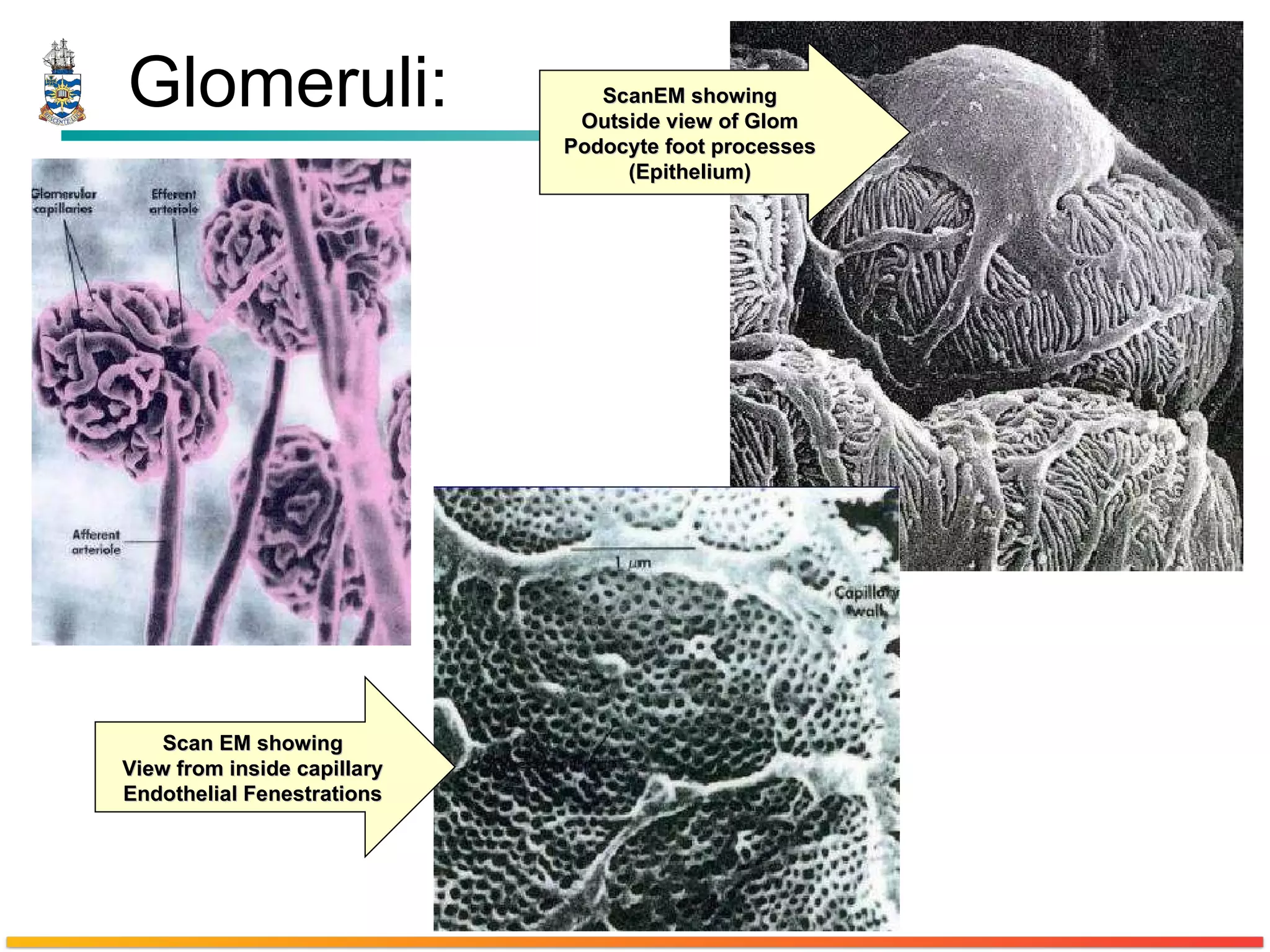 Glomeruli: ScanEM showing Outside view of Glom Podocyte foot processes (Epithelium) Scan EM showing View from inside capillary Endothelial Fenestrations 