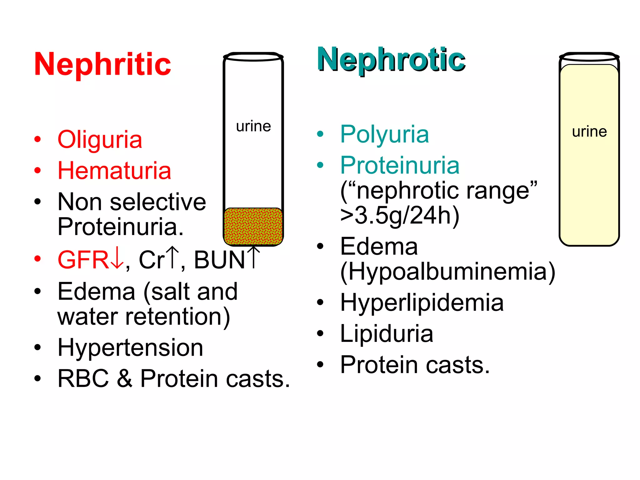Nephritic Oliguria Hematuria Non selective Proteinuria. GFR  , Cr  , BUN  Edema (salt and water retention) Hypertension RBC & Protein casts. Nephrotic Polyuria Proteinuria  (“nephrotic range” >3.5g/24h) Edema (Hypoalbuminemia) Hyperlipidemia Lipiduria Protein casts. urine urine 