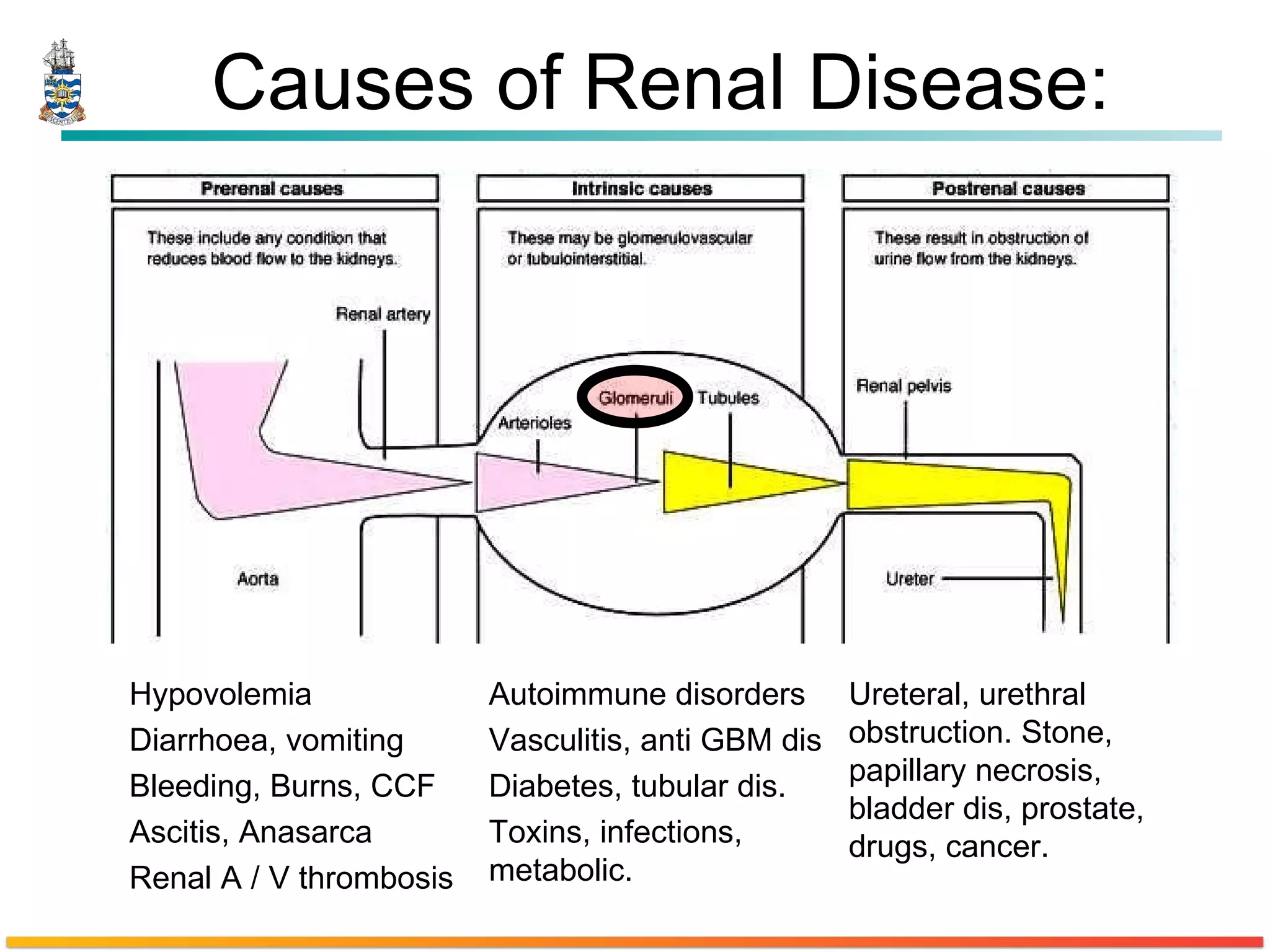 Causes of Renal Disease: Hypovolemia Diarrhoea, vomiting Bleeding, Burns, CCF Ascitis, Anasarca Renal A / V thrombosis Autoimmune disorders Vasculitis, anti GBM dis Diabetes, tubular dis. Toxins, infections, metabolic. Ureteral, urethral obstruction. Stone, papillary necrosis, bladder dis, prostate, drugs, cancer. 