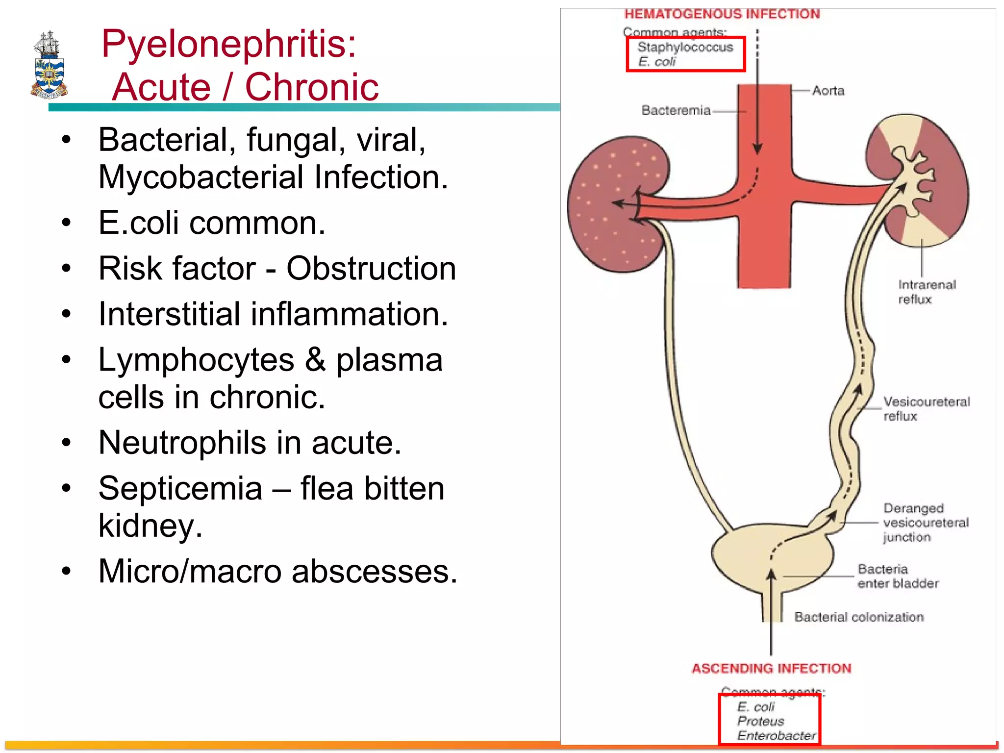 Pyelonephritis:  Acute / Chronic Bacterial, fungal, viral, Mycobacterial Infection. E.coli common. Risk factor - Obstruction  Interstitial inflammation. Lymphocytes & plasma cells in chronic. Neutrophils in acute. Septicemia – flea bitten kidney. Micro/macro abscesses. 