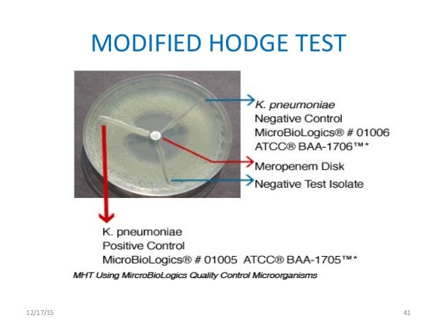 CLINICOPATHOLOGICAL CASE DISCUSSION _ ON ESBL producing bacteria