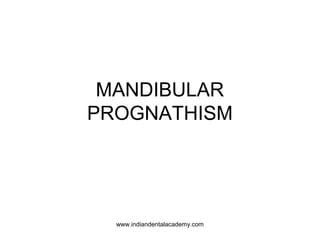 MANDIBULAR
PROGNATHISM

www.indiandentalacademy.com

 
