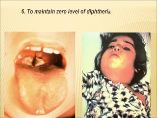 6. To maintain zero level of diphtheria.
 