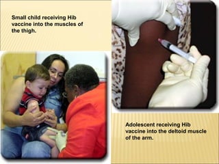Small child receiving Hib
vaccine into the muscles of
the thigh.
Adolescent receiving Hib
vaccine into the deltoid muscle
of the arm.
 