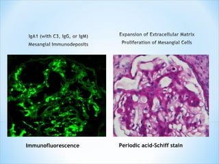 Immunofluorescence Periodic acid-Schiff stain 