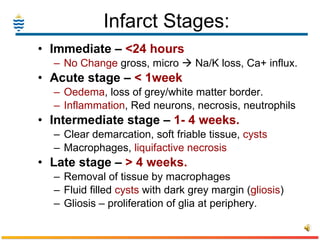 Infarct Stages: Immediate –  <24 hours No Change  gross, micro    Na/K loss, Ca+ influx. Acute stage –  < 1week  Oedema , loss of grey/white matter border. Inflammation , Red neurons, necrosis, neutrophils Intermediate stage –  1- 4 weeks. Clear demarcation, soft friable tissue,  cysts Macrophages,  liquifactive necrosis Late stage –  > 4 weeks. Removal of tissue by macrophages Fluid filled  cysts  with dark grey margin ( gliosis ) Gliosis – proliferation of glia at periphery.  