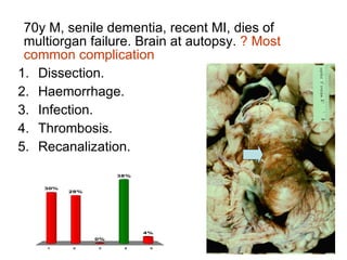 70y M, senile dementia, recent MI, dies of multiorgan failure. Brain at autopsy.  ? Most common complication Dissection.  Haemorrhage. Infection. Thrombosis. Recanalization. 
