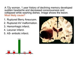A 72y woman, 1 year history of declining memory developed sudden headache and decreased consciousness and collapsed while washing dishes. Image shows the lesion.  Most likely cause? Ruptured Berry Aneurysm. Ruptured AV malformation. Hemorrhagic infarct. Lacunar infarct. AS- embolic infarct. 