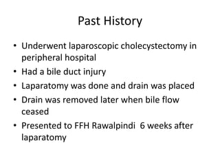Cpc bile duct injuries | PPTX