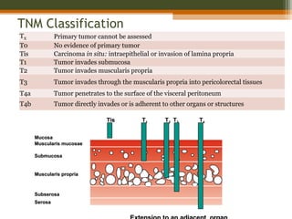 Tis TTis T11 TT22 TT33 TT44
MucosaMucosa
Muscularis mucosaeMuscularis mucosae
SubmucosaSubmucosa
Muscularis propriaMuscularis propria
SubserosaSubserosa
SerosaSerosa
TNM Classification
TX Primary tumor cannot be assessed
T0 No evidence of primary tumor
Tis Carcinoma in situ: intraepithelial or invasion of lamina propria
T1 Tumor invades submucosa
T2 Tumor invades muscularis propria
T3 Tumor invades through the muscularis propria into pericolorectal tissues
T4a Tumor penetrates to the surface of the visceral peritoneum
T4b Tumor directly invades or is adherent to other organs or structures
 