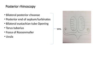 Posterior rhinoscopy
• Bilateral posterior choanae
• Posterior end of septum/turbinates
• Bilateral eustachian tube Opening
• Torus tubarius
• Fossa of Rossenmuller
• Uvula
WNL
 