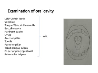 Examination of oral cavity
Lips/ Gums/ Teeth
Vestibule
Tongue/Floor of the mouth
Buccal mucosa
Hard/soft palate
Uvula
Anterior pillar
Tonsils
Posterior pillar
Tonsillolingual sulcus
Posterior pharyngeal wall
Retromolar trigone
WNL
 