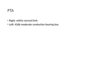 PTA
• Right: within normal limit
• Left: 42db moderate conductive hearing loss
 