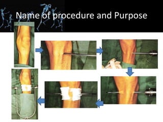 High Riding Prostate Sign Cpc orthopaedics | PPTX