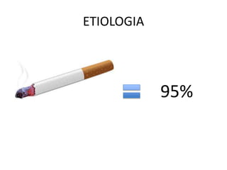 ETIOLOGIA
95%
 