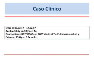 Caso Clínico
Entre el 06.02.17 – 17.02.17
Recibió 30 Gy en 10 Fx en 2s.
Concomitante RDT VMAT con CBCT diario al Tu. Pulmonar residual y
Esternon 25 Gy en 5 Fx en 2s.
 
