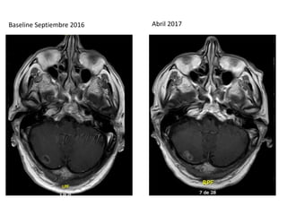 Baseline Septiembre 2016 Abril 2017
 