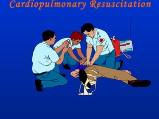 Cardiopulmonary Resuscitation

 