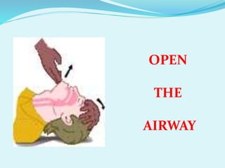 OPEN
THE
AIRWAY
 